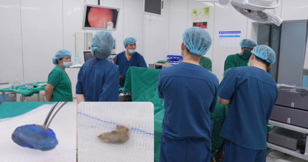 Bé gái 4 tuổi tiết dịch hôi vùng kín suốt 1 tháng, bác sĩ phát hiện 2 dị vật ở sâu bên trong