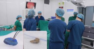Bé gái 4 tuổi tiết dịch hôi vùng kín suốt 1 tháng, bác sĩ phát hiện 2 dị vật ở sâu bên trong