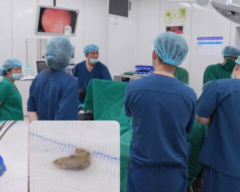 Bé gái 4 tuổi tiết dịch hôi vùng kín suốt 1 tháng, bác sĩ phát hiện 2 dị vật ở sâu bên trong