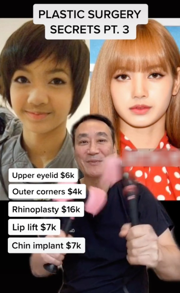 Lisa (BLACKPINK) “dao kéo” quá tay đến mức phá nét, fan cũng ngớ cả người- Ảnh 5.
