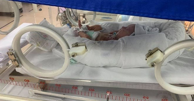 Các yếu tố nguy cơ dẫn đến sinh non mẹ bầu cần lưu ý - Ảnh 1.
