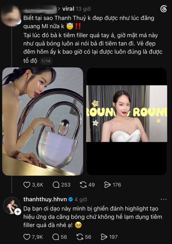 Bị nói lạm dụng thẩm mỹ, không còn đẹp tự nhiên, Thanh Thuỷ lên tiếng- Ảnh 3.