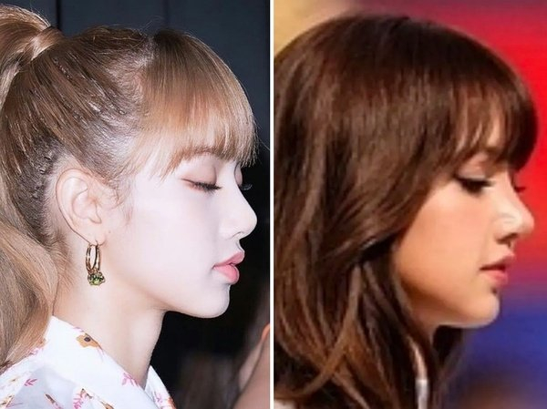 Còn chê Lisa nâng mũi hỏng nữa không?- Ảnh 5.