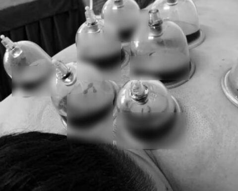 Trào lưu “chích máu chữa đột quỵ” khiến bác sĩ lạnh người