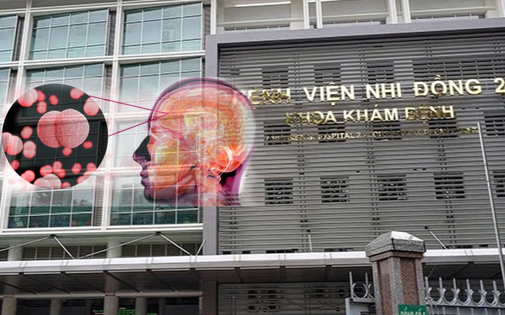 Nhiễm khuẩn do não mô cầu hay gặp trong mùa đông xuân