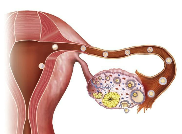 Biện pháp tránh thai nội tiết tố có thể gây vô sinh? - Ảnh 4.